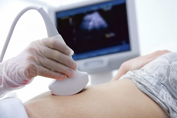 ultrasound-queens-gynecology-services